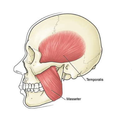 botox for tmj in nyc and long island, donald tanenbaum, BOTOX® masseter, BOTOX® temporalis