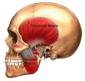 massage for TMJ, temporalis and masseter
