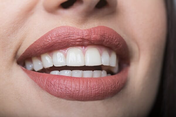 Is BOTOX for TMJ Safe?