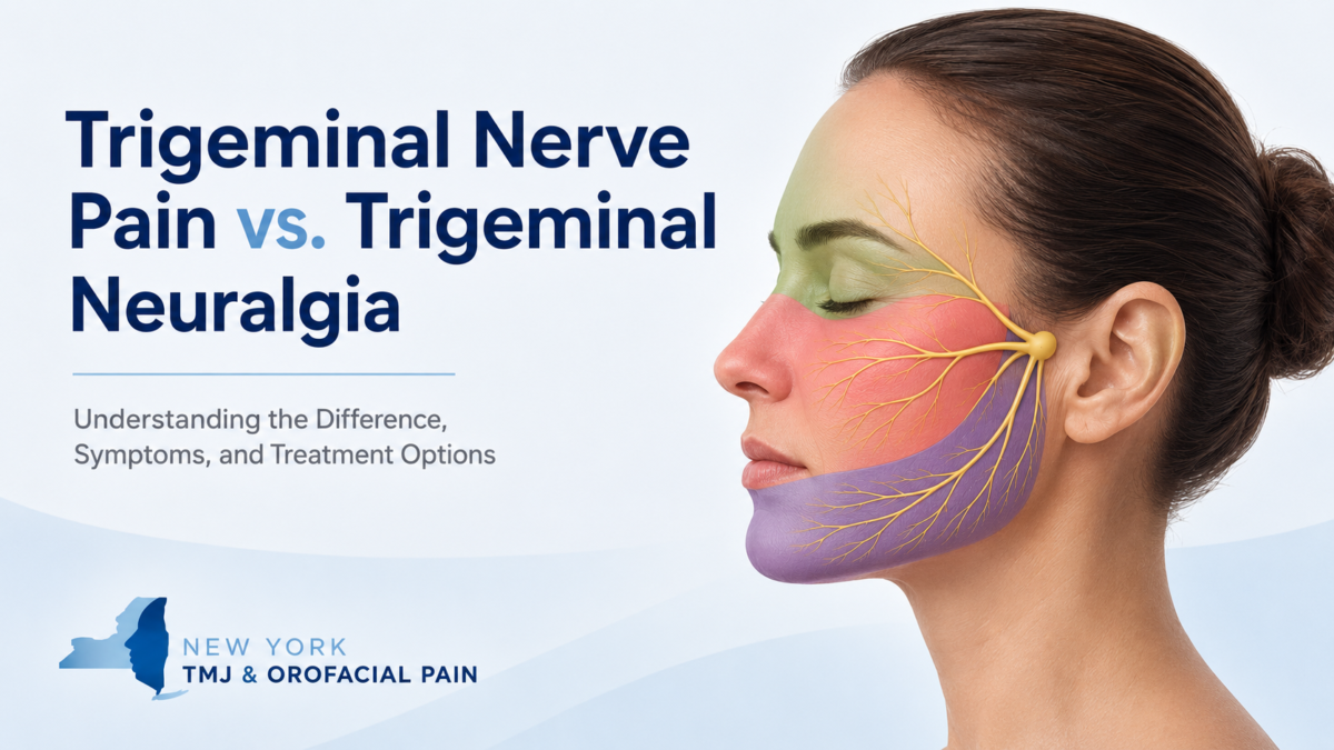 Illustration showing facial pain regions associated with trigeminal nerve pain and trigeminal neuralgia