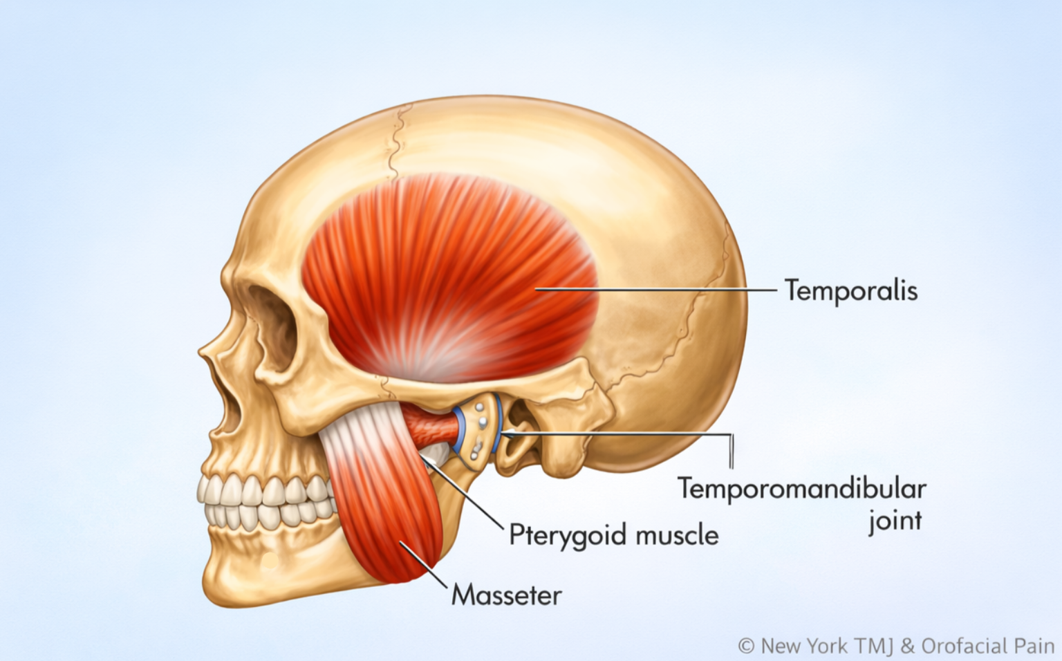 Lateral anatomical illustration of the temporomandibular joint and muscles of mastication including the temporalis, masseter, and pterygoid muscle