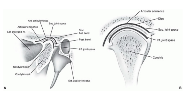 temporomandibular joint disc condyle joint space instability diagram